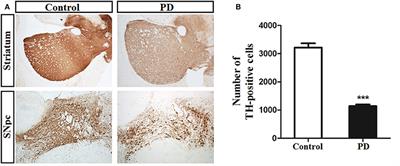 Metabolic Disturbances in the Striatum and Substantia Nigra in the Onset and Progression of MPTP-Induced Parkinsonism Model